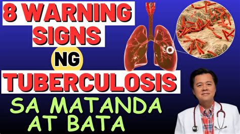 8 Warning Signs ng Tuberculosis sa Matanda at Bata. .